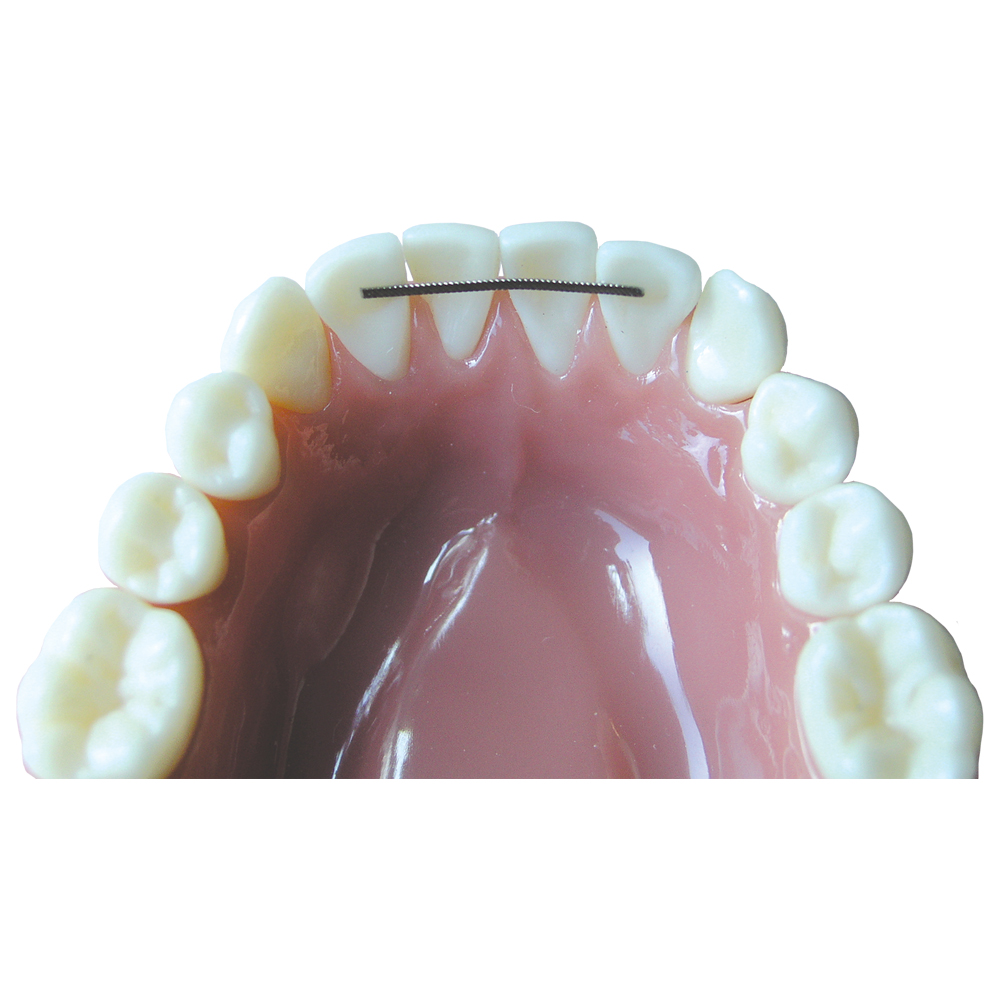 Banded Retainer