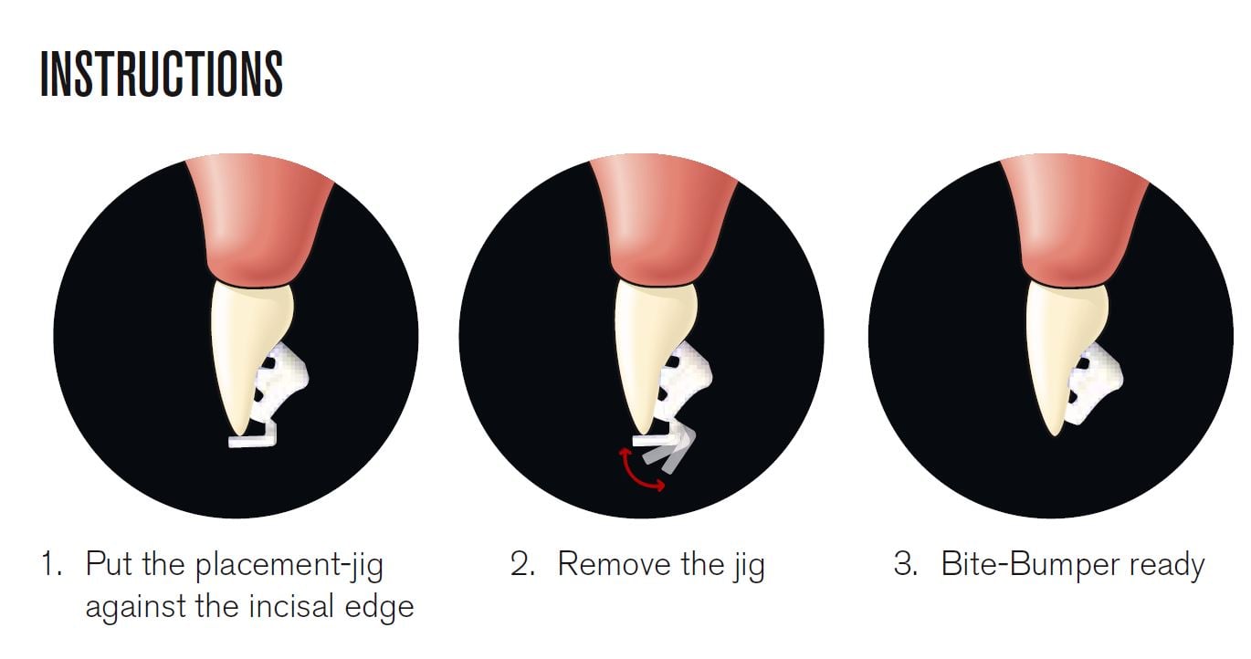 Instructions for use for Bite Bumper