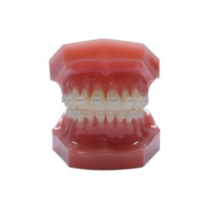 (10 carats) Arc en acier inoxydable (SS) couleur dent, naturel