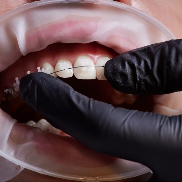 Blackjack Latex Dental Exam Gloves