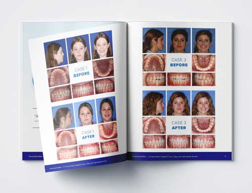 ORAPRO-Cases-Mock-Up Orapro Cases Mock Up