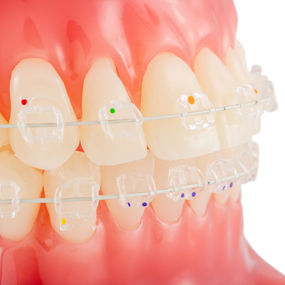 ToothColored Nickel Titanium (NiTi) Archwire, Natural (10ct)