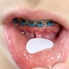 Mouth Aid 2