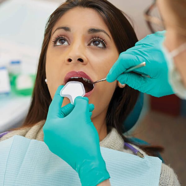 Microbrush Dry Tips Patient In Use
