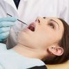Microbrush X Extended Reach Applicator Clinical Close Px100 600x600 0
