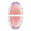 Mouth Area Anterior 600x600 20