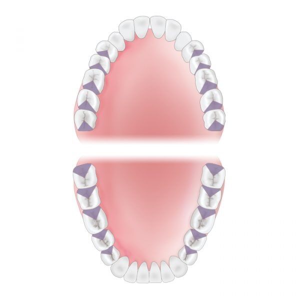 Mouth Area Distal 600x600 8